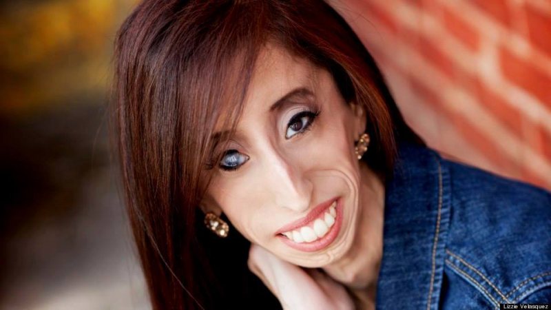 ليزي فلاسكويز -  Lizzie Velasquez